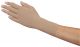 Juzo flat knit custom compression glove for lymphedema